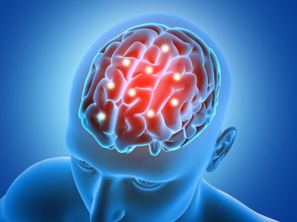 Neurological Conditions
